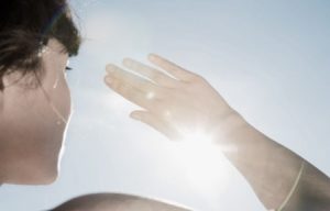 avoid sunlight | www.beautyandlaserclinic.com.au