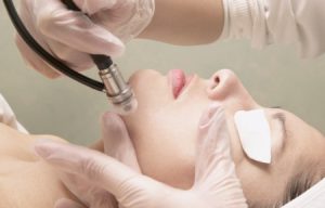 dark spot removal | Beauty and laser Clinic