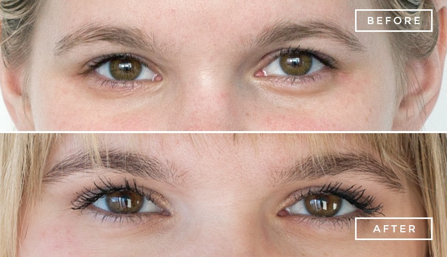Eyelash Tinting Beauty and Laser Clinic