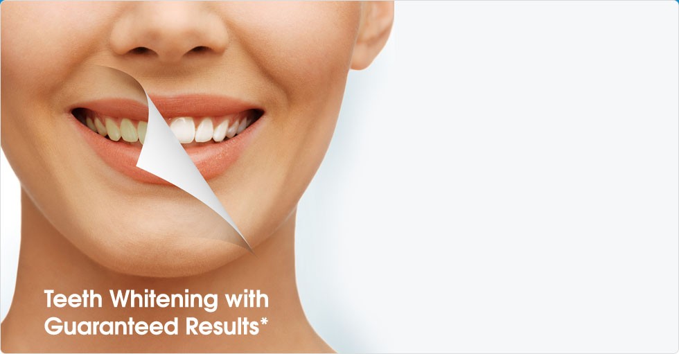 teet whitening 