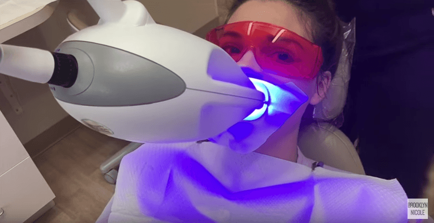 Teeth Whitenning Beauty Laser Clinic Manly Sydney Northern Beaches 