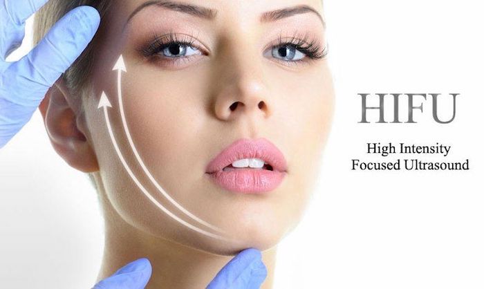 High-Intensity Focused Ultrasound (HIFU)